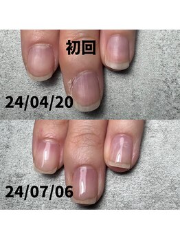 縦長すっきりお爪さんに