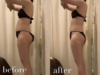 上野エステサロン レア(Lea)/痩身