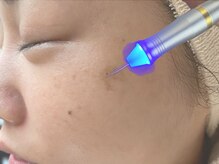 ドゥクス 難波店(Dux)