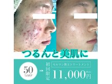 エーケーエステティックス 熊本新市街店(AK Esthetics)の雰囲気（【セルマン】ホームケア×サロンケアで徹底集中ケア！）