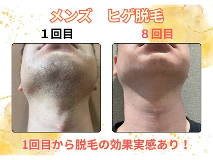 グローアップ(Glow up)の写真