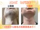 グローアップ(Glow up)の写真