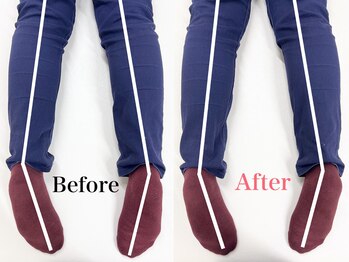 寿 上野院(KOTOBUKI)/整体/上野/肩こり/上野整体