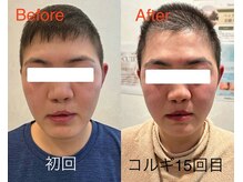 ビーキュート 姫路店(BE-CUTE)/コルギ15回目