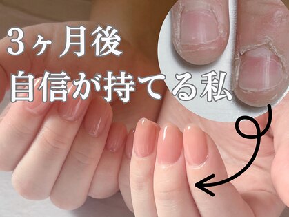 アメジスト(Amethyst)の写真