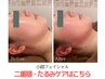 【小顔エステ】お顔スッキリ＆たるみ改善！むくみケア　70分コース