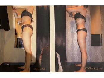 パーフェクトボディプレミアム 京都店(PERFECT BODY PREMIUM)/お客様　ビフォーアフター（30）