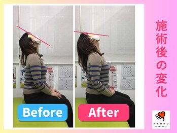 ナオル整体 川越院(NAORU整体)/肩こりがスッキリ【整体/矯正】