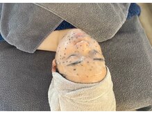 ステッラ(STELLA☆)/ハイドロジェリーマスク