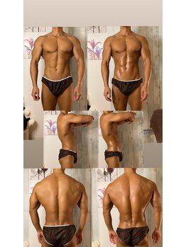 京橋メンズビューティーラボ(KMB LAB.)/ハイパーナイフのbefore/after