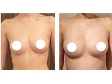 エスビューティー 三軒茶屋(S beauty)/たるみ・駒澤大学・痩身