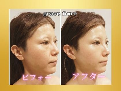 グレースフィオーレ 南越谷店(gracefiore)の写真
