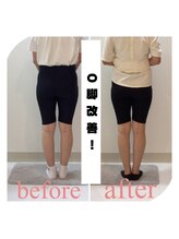 スタイルラボ高松/O脚矯正の効果♪