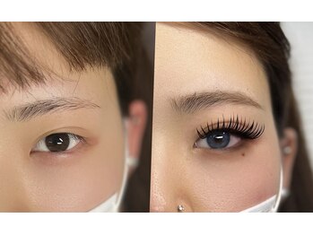 エムエム(mm)/メガフラット+シャインリフト