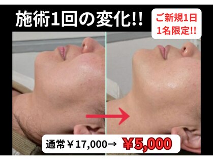 エクラ(e'clat)の写真