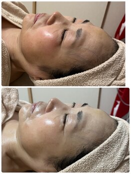 コア(Coeur)/【本格肌管理】オールハンド美肌