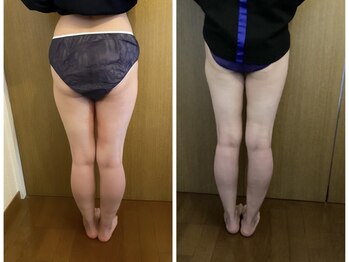 アリス 赤坂/太もも8カップ6回合計48カップ