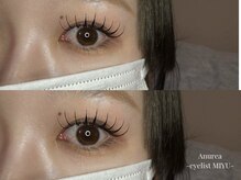 アニュレア バイ レヴィエリス(Anurea by Re’VIELISS)/フラットラッシュ140本