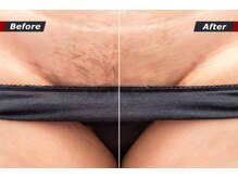 アールワイ(RY)の雰囲気(【結果重視】フェムケアサロンの脱毛。かなり抜けます!!部分ok)