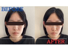 たかす整骨院/顔の長さ/左右差/目の高さ