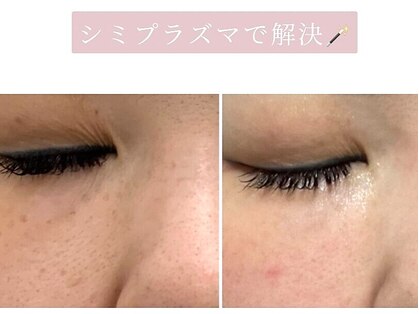 アース コアフュールボーテ 龍ヶ崎店(EARTH coiffure beaute)の写真