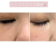 アース コアフュールボーテ 龍ヶ崎店(EARTH coiffure beaute)