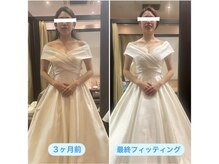 トータルボディケア サニー(TOTAL BODY CARE)/ブライダルエステbefore after