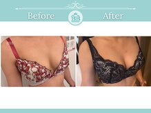 美人バスト 渋谷店/【バストアップ・育乳】◇症例◇