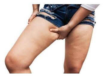 ヨサパーク フラネ(YOSA PARK Flaner)の写真/「痩せにくい」とお悩みの下半身。垂れてきたお尻、太ももの張り…根本原因の【冷え/むくみ】を徹底ケア!!