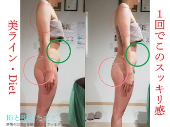 RiとBiのたまごの写真/【夏やせ】フランス発・国際特許取得の最新機スターバック×長年磨き抜いた技術で本気ダイエット
