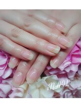 アイネイル(iNAIL)/