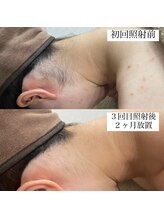 テンパ ビューティー(+10%beauty)/効果写真