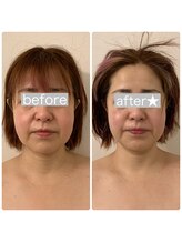 ラヴィエ ベル(La vie est belle)/ゼロコルギ本コースで小顔に！！