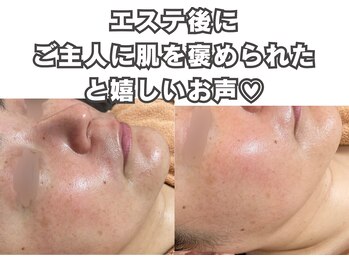 フェイス(FACE)/施術経過