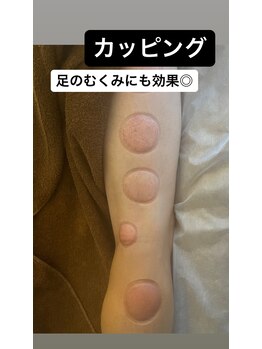 リベル(Liber)/カッピングでむくみケア