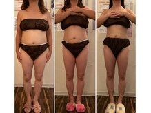 トータルビューティーサロン 凛/凛の結果だしダイエット