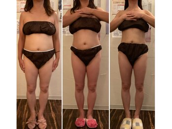 トータルビューティーサロン 凛/凛の結果だしダイエット