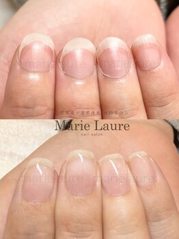 マリーロール 淀屋橋本店(Marie Laure)/自爪育成/深爪矯正/ネイルケア