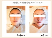 フェイシャルストーリー(Facial story)の雰囲気（最強の小顔縮小術/小顔矯正筋膜韓国コルグン【コルギ×筋膜】）
