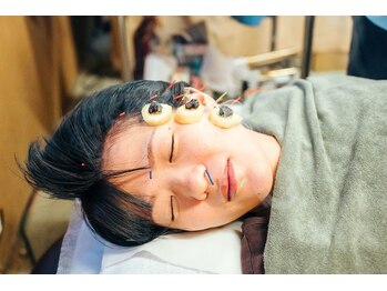 中村温灸院/美容鍼