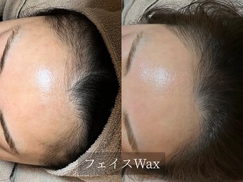 アルム(Arum)/フェイスWax