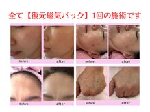 皆様の効果の詳細はブログをご参照くださいませ。