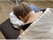 ケーホーム(K-HOME)の雰囲気（痛む箇所を中心に鍼を打ちます♪）