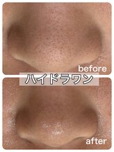 ルポアン(Repos an)/毛穴◎黒ずみ◎ざらつき◎