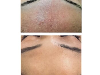 シード(SHE°)/陶肌トリートメント