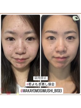 木の葉/若よもぎ蒸し（バラエティー）