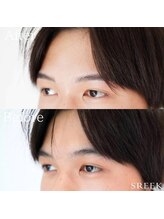 スリーク(SREEK)/脱毛施術と一緒でも大丈夫