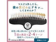 ホワイトニングカフェ 盛岡大通店(WhiteningCafe)