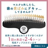 ホワイトニングカフェ 盛岡大通店(WhiteningCafe)