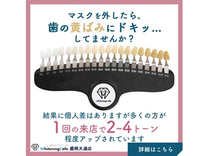ホワイトニングカフェ 盛岡大通店(WhiteningCafe)の写真